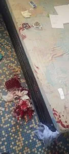 Drame à Bouaké : un étudiant tente de se suicider (photo) Drame à Bouaké : un étudiant tente de se suicider (photo) | Affairage.ci