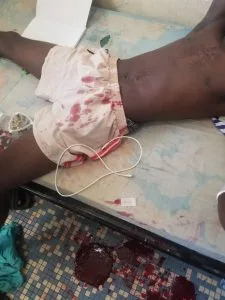 Drame à Bouaké : un étudiant tente de se suicider (photo) Drame à Bouaké : un étudiant tente de se suicider (photo) | Affairage.ci